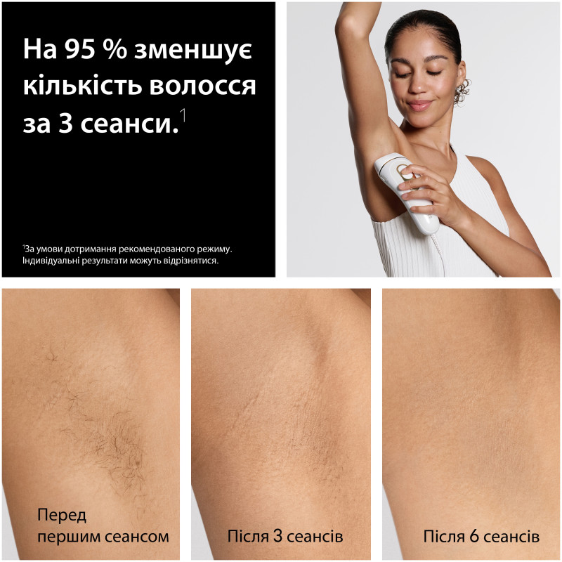 Эпилятор Braun Silk Expert Pro 5 PL5412 + Триммер для лица + Бритва Gillette Venus Extra Smooth + Косметичка (8700216938006)